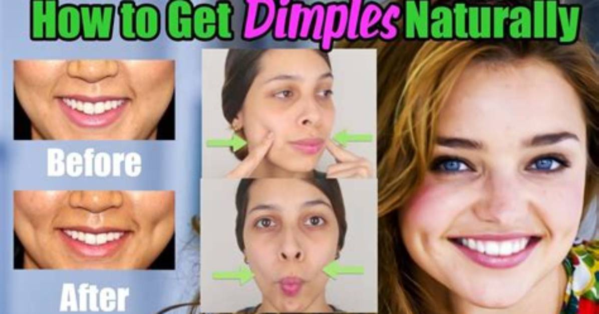 Can Dimples Go Away?