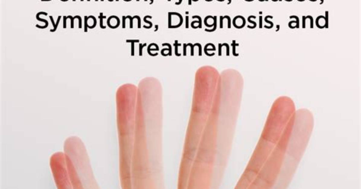 Can Diplopia Be Permanent