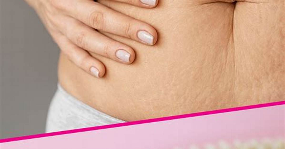 Can Dry Brushing Help Stretch Marks?