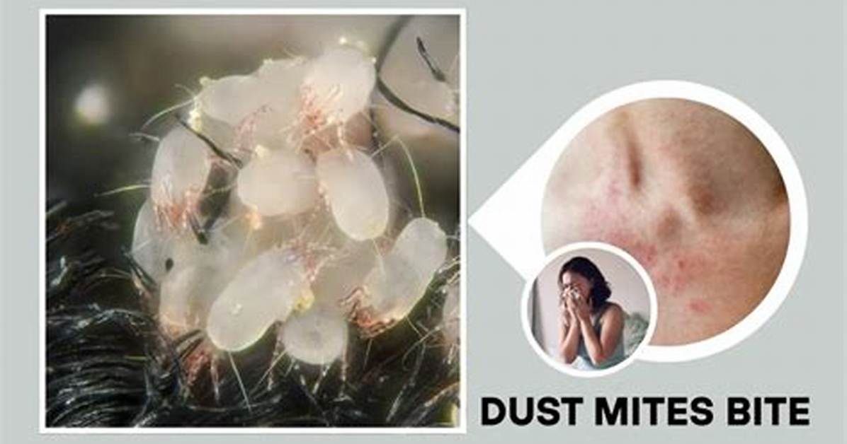 Can Dust Mites Bite You