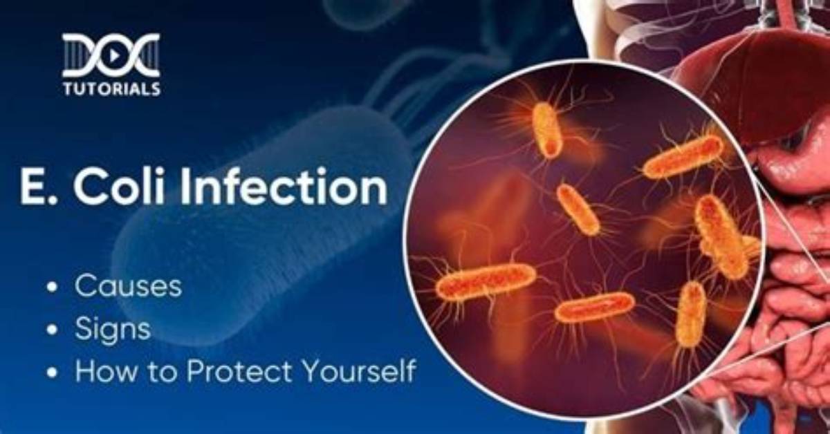 Can E. Coli Cause Bv?