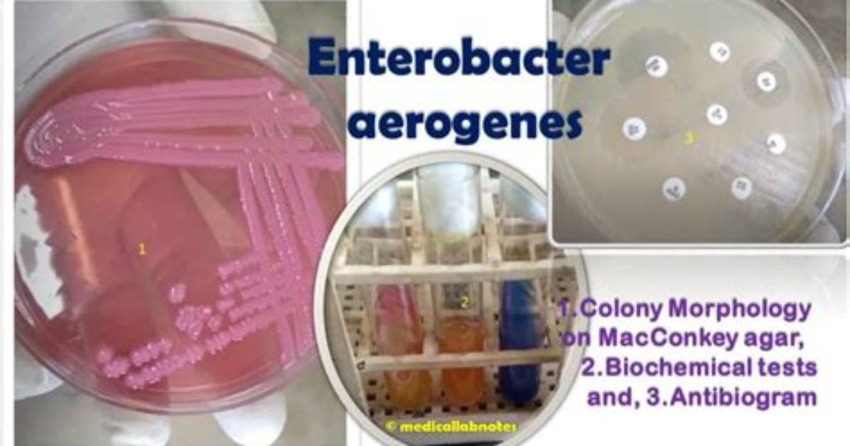 Can Enterobacter Aerogenes Ferment Mannitol?
