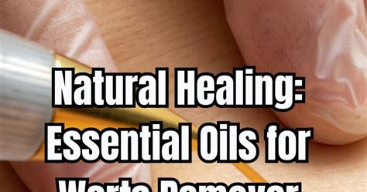 Can Essential Oils Kill Warts