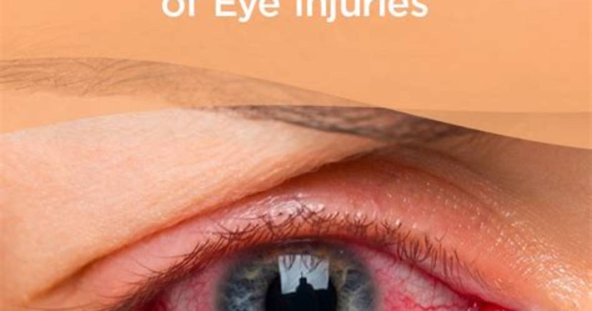 Can Eye Rolling Damage?