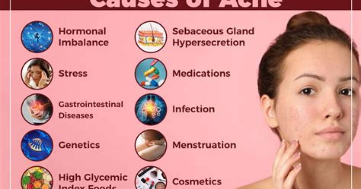 Can Folate Cause Acne?