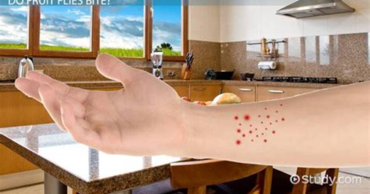 Can Fruit Flies Bite?