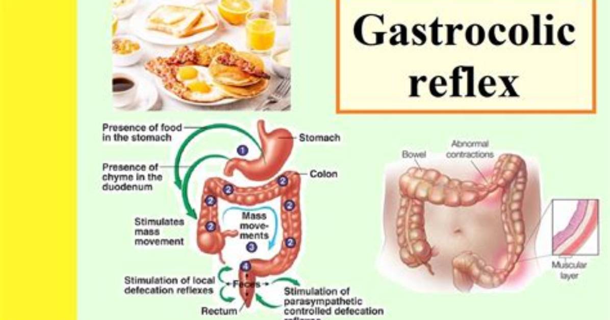 Can Gastrocolic Reflex Causes Diarrhea?