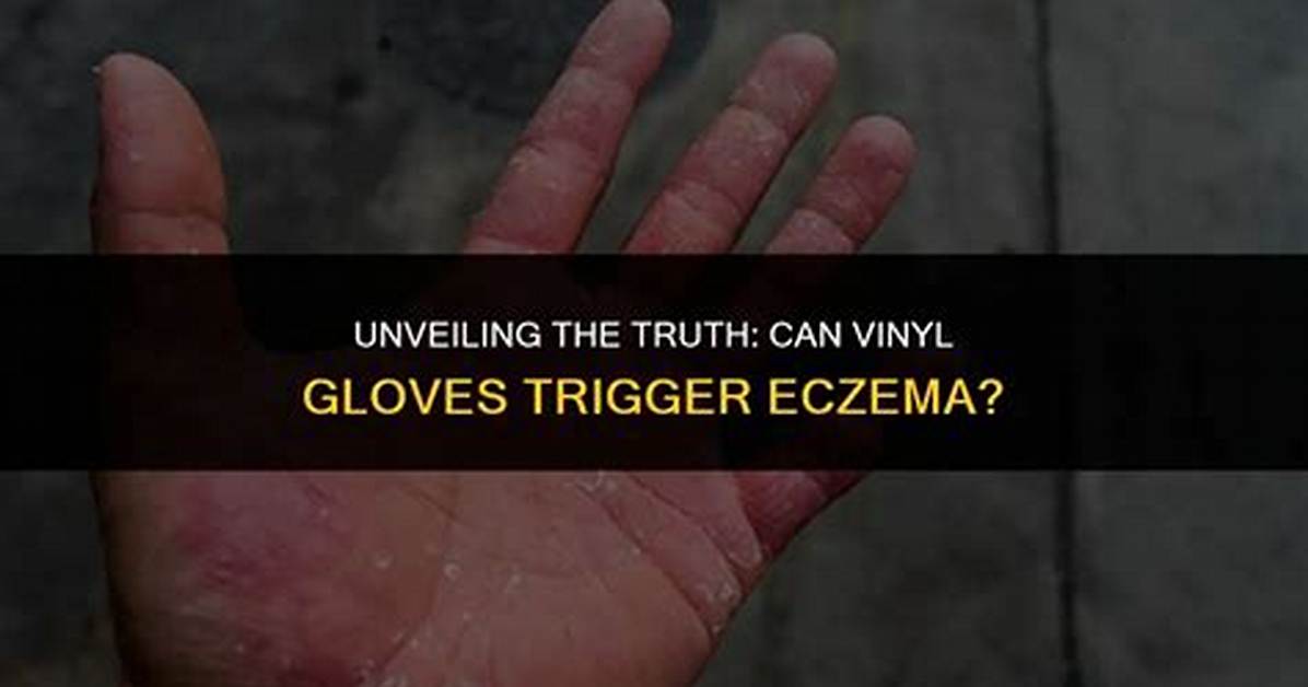 Can Gloves Cause Eczema