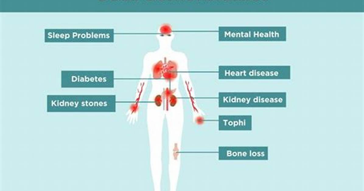 Can Gout Kill You?