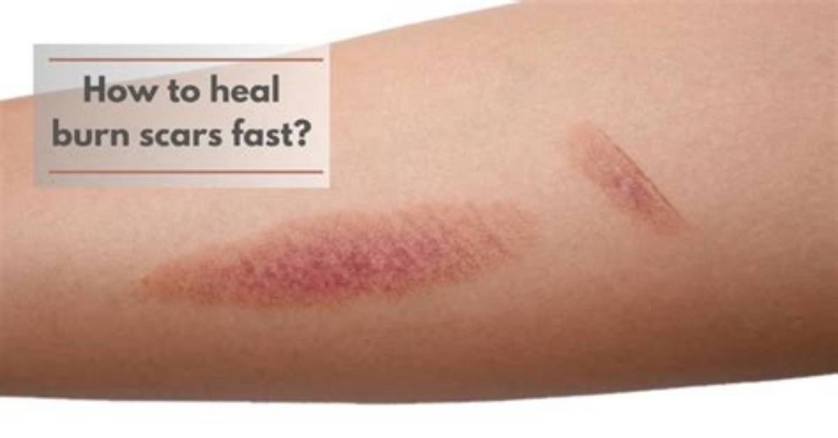 Can Healed Scars Hurt?
