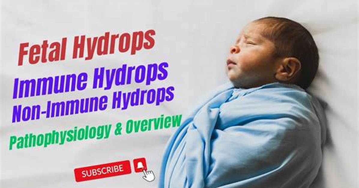 Can Hydrops Go Away
