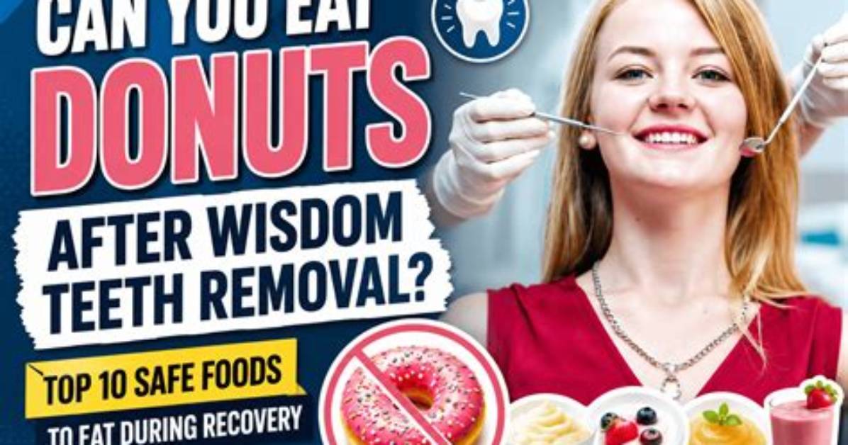 Can I Eat Donuts After Wisdom Teeth Removal