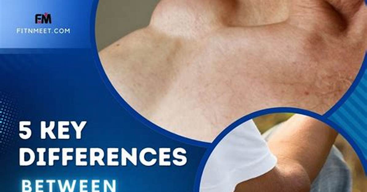 Can Liposarcoma Be Cured?
