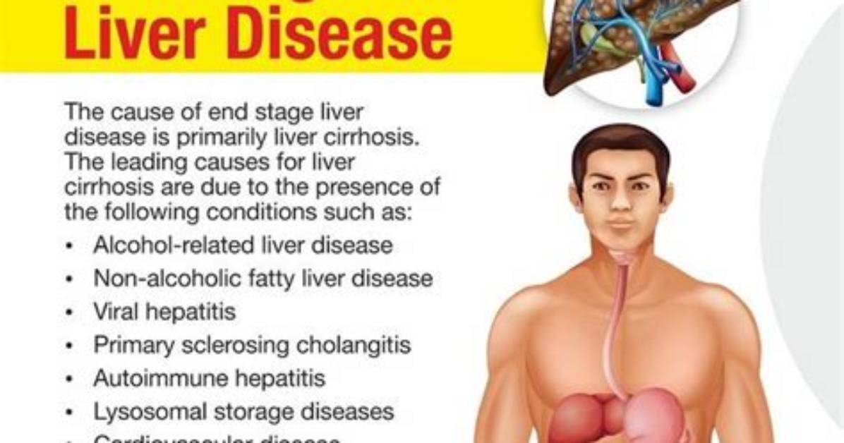 Can Liver Cause Digestive Problems