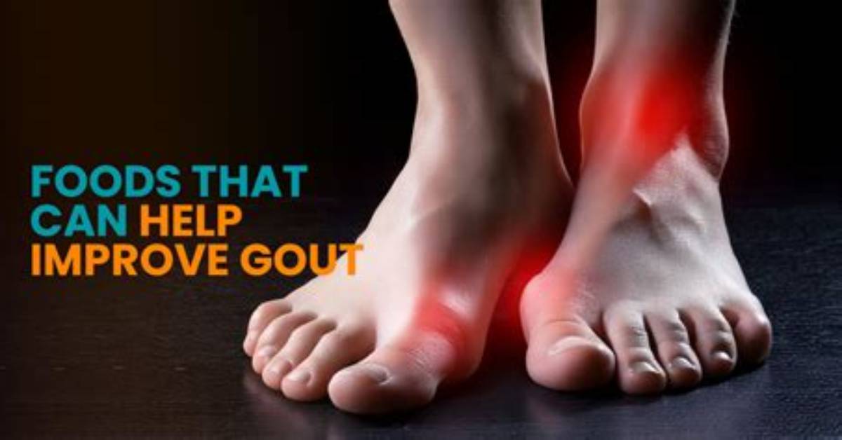 Can Losing Weight Trigger Gout