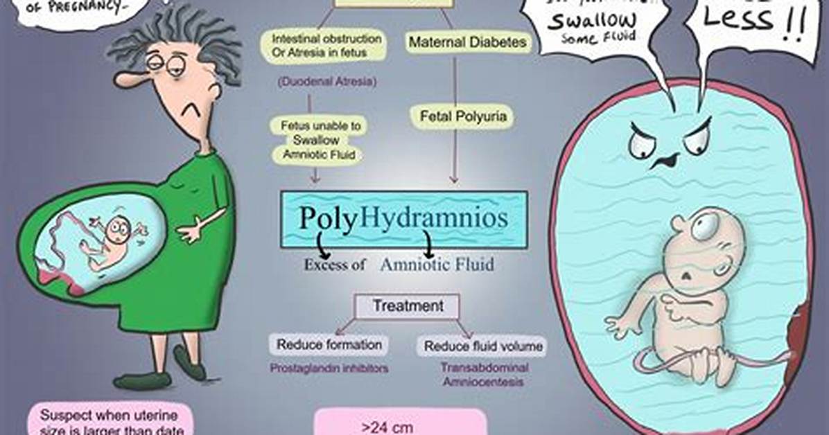 Can Macrosomia Cause Polyhydramnios?