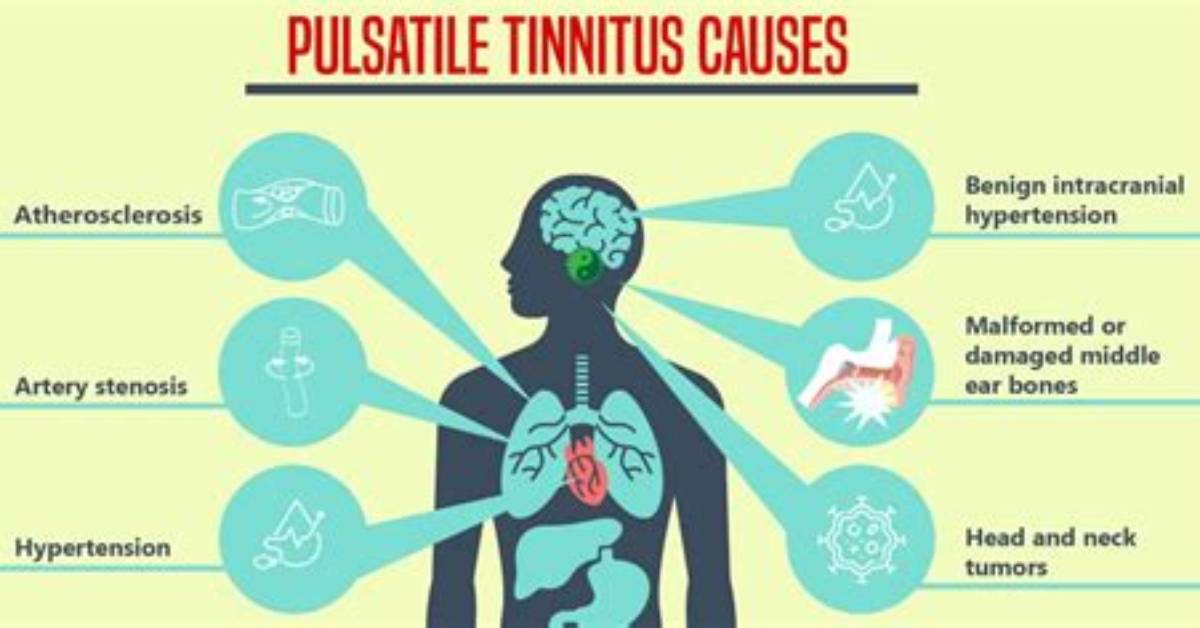 Can Neck Problems Cause Pulsatile Tinnitus