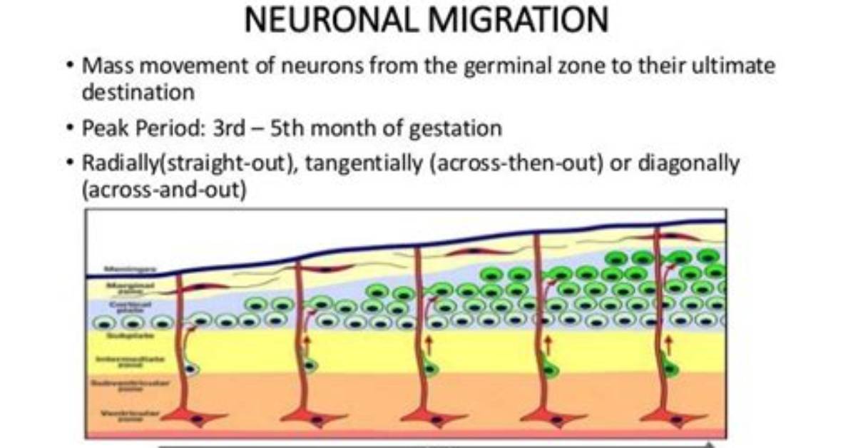 Can Neuronal Migration Be Cured?