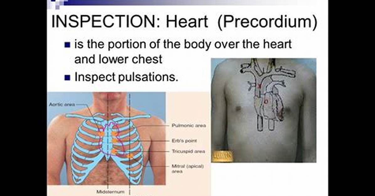 Can Nurses Do Precordial Thumps?