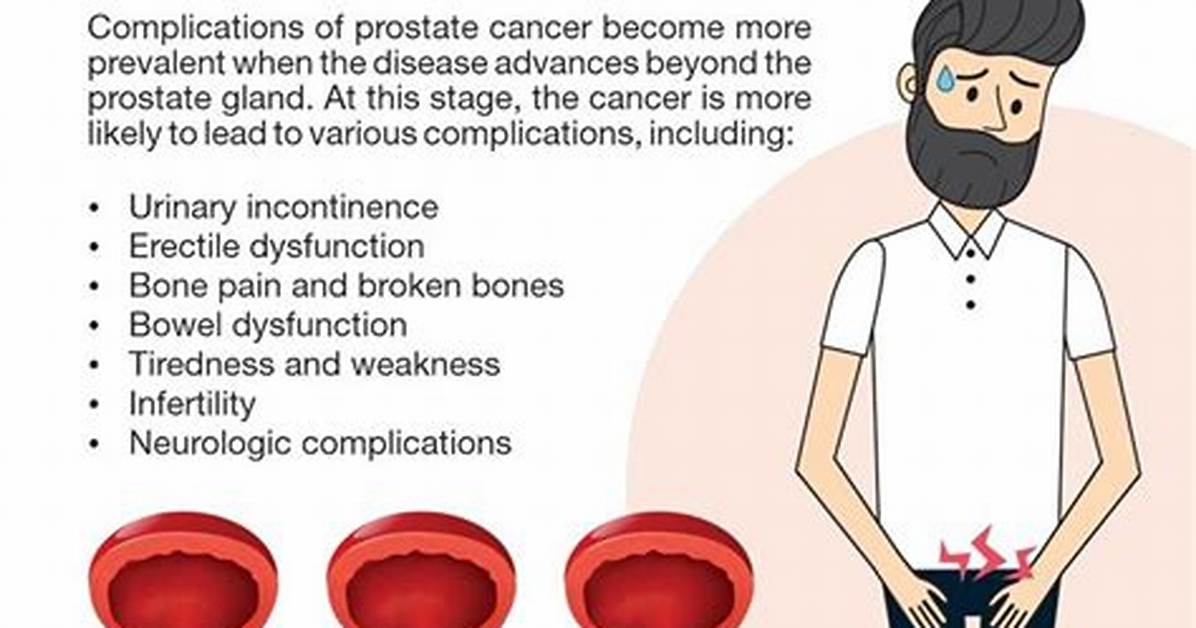 Can Prostate Cause Death?