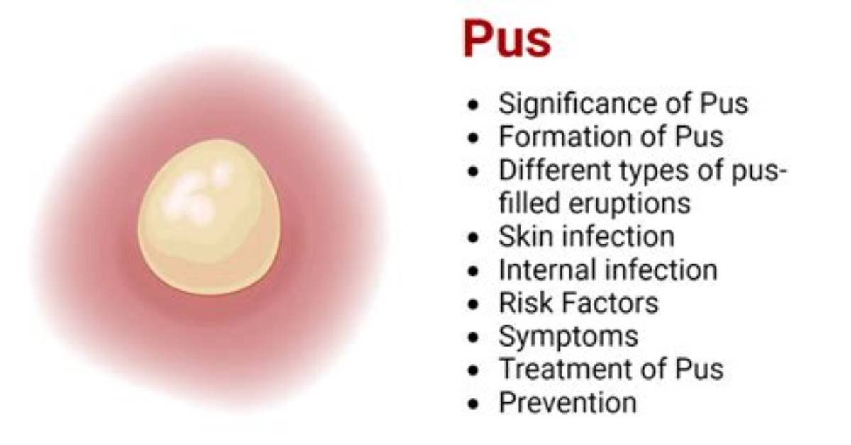 Can Pus Be Clear?