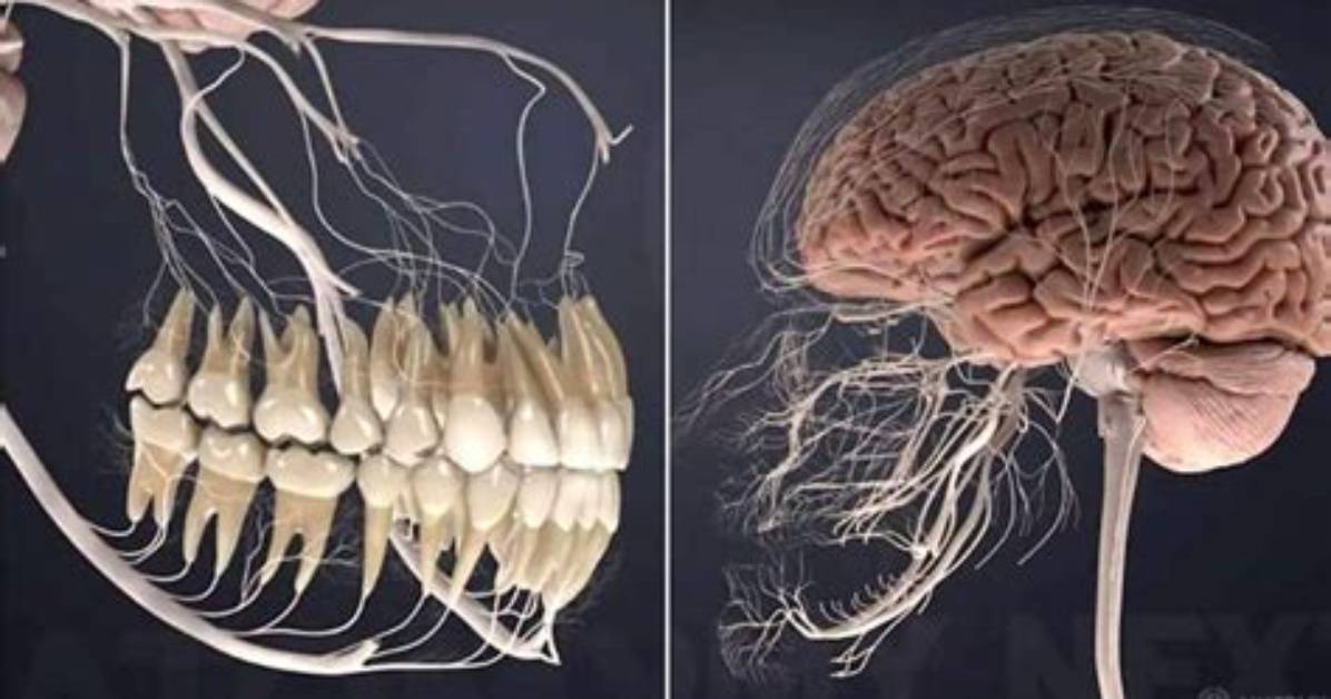 Can Rotten Teeth Affect Your Brain?