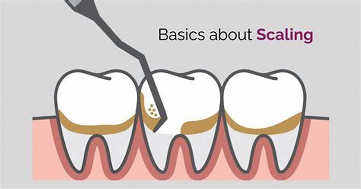 Can Scaling Damage Teeth?