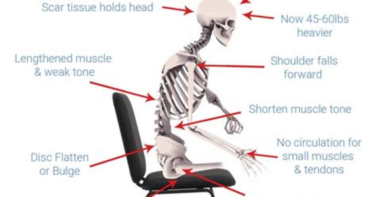 Can Sitting Posture Cause Back Pain?