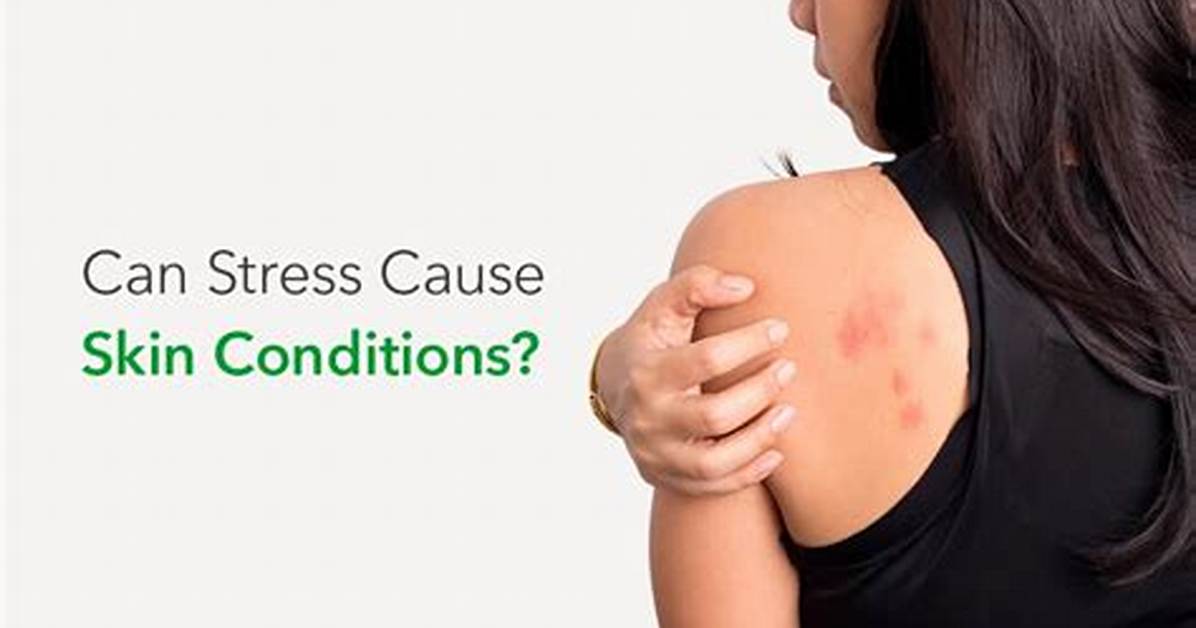 Can Sulfites Cause Skin Problems