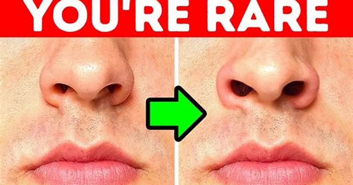 Can't Stop Flaring Nostrils?