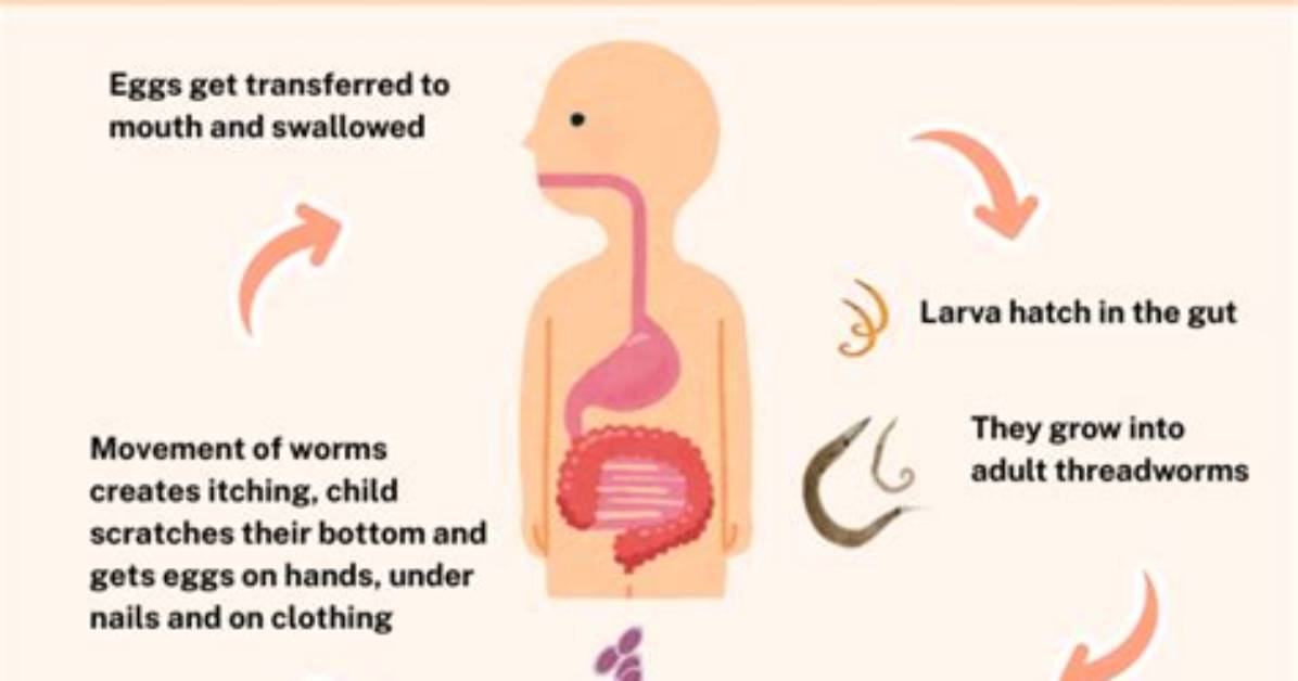 Can Threadworms Live in Your Nose?