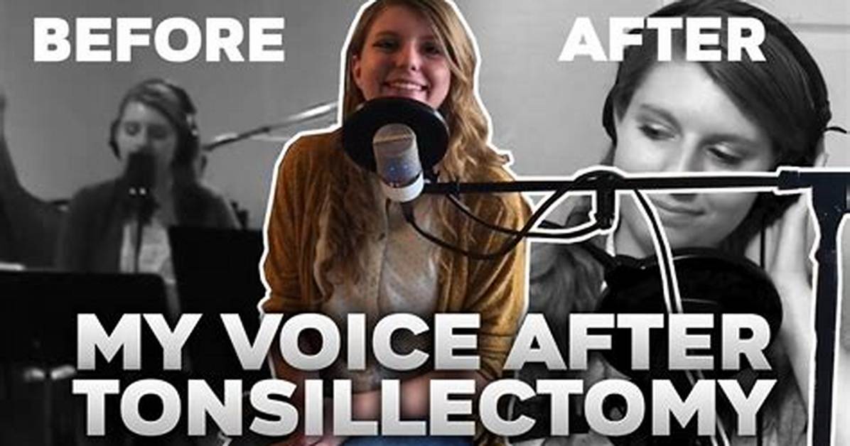 Can Tonsillectomy Change Your Voice?