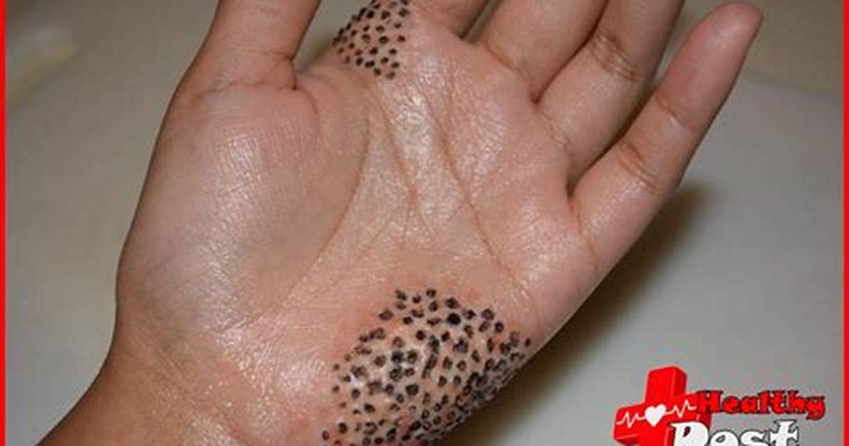 Can Trypophobia Kill You?