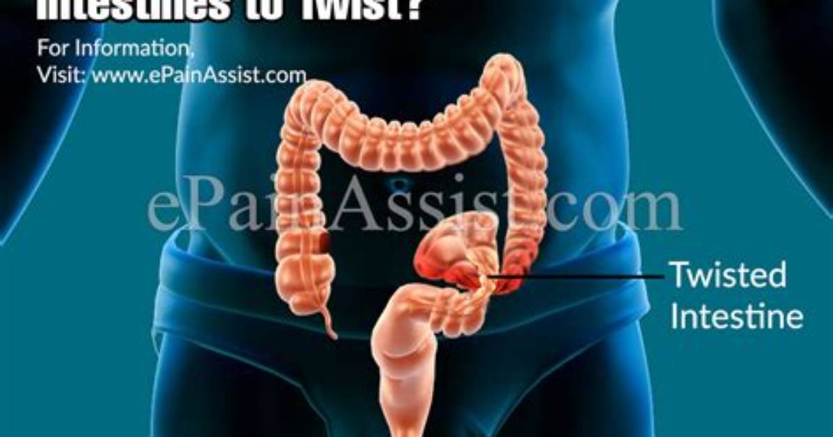 Can Twisted Intestines Kill You?