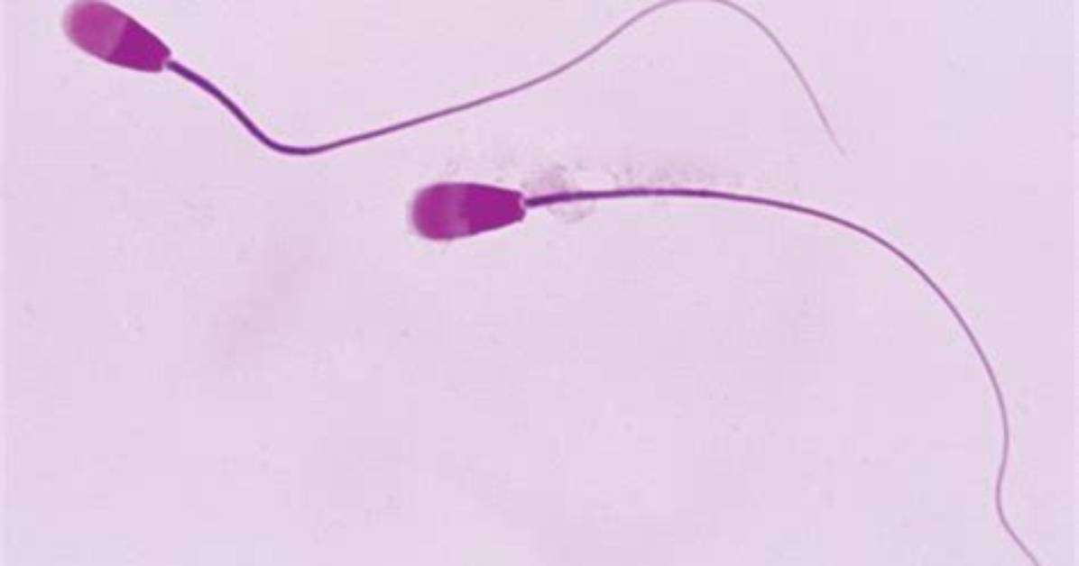 Can Two Sperm Cells Be Combined?