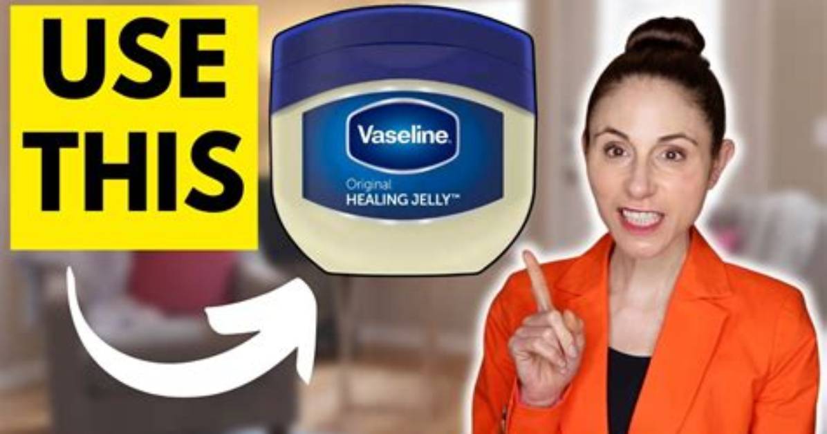 Can Vaseline Stop Itching?