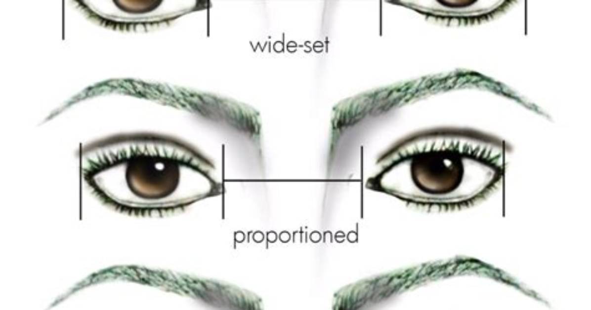 Can Wide Set Eyes Be Normal?