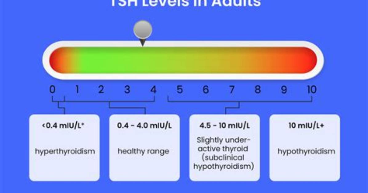 Can You Be Hyperthyroid with Normal Tsh?
