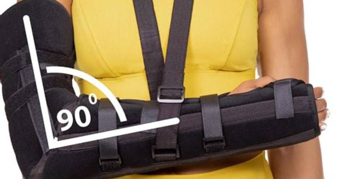 Can You Get Arm Splints