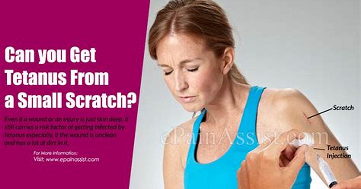 Can You Get Tetanus from a Small Scratch?