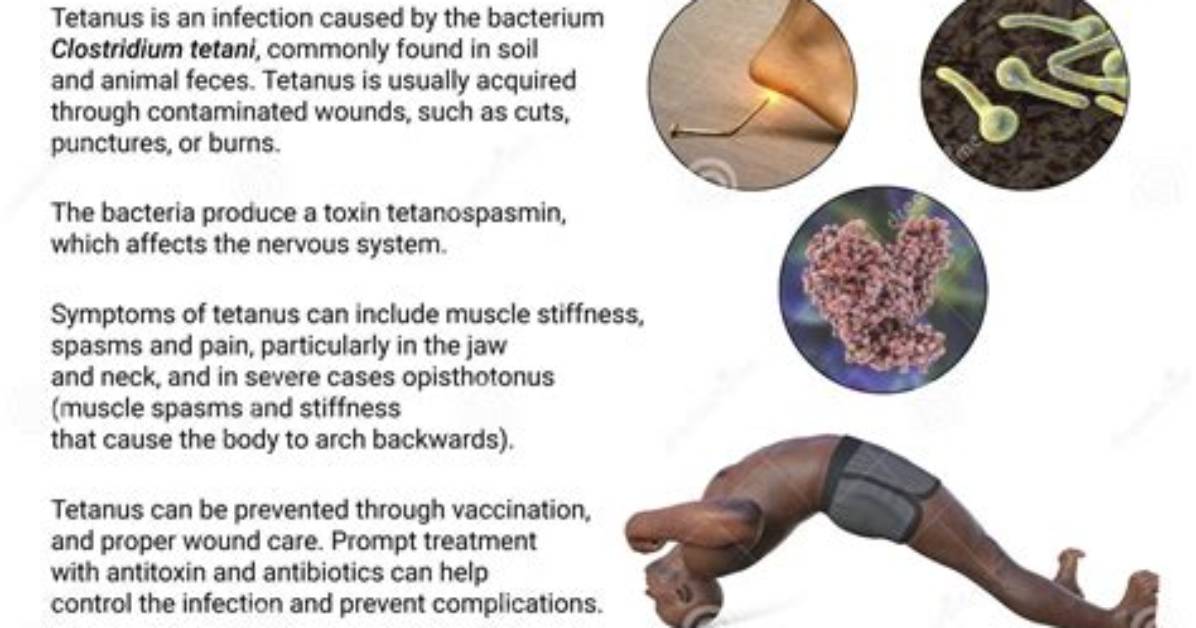 Can You Get Tetanus from Rust?