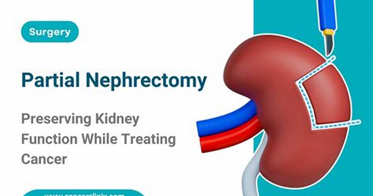 Can You Have a Partial Nephrectomy?