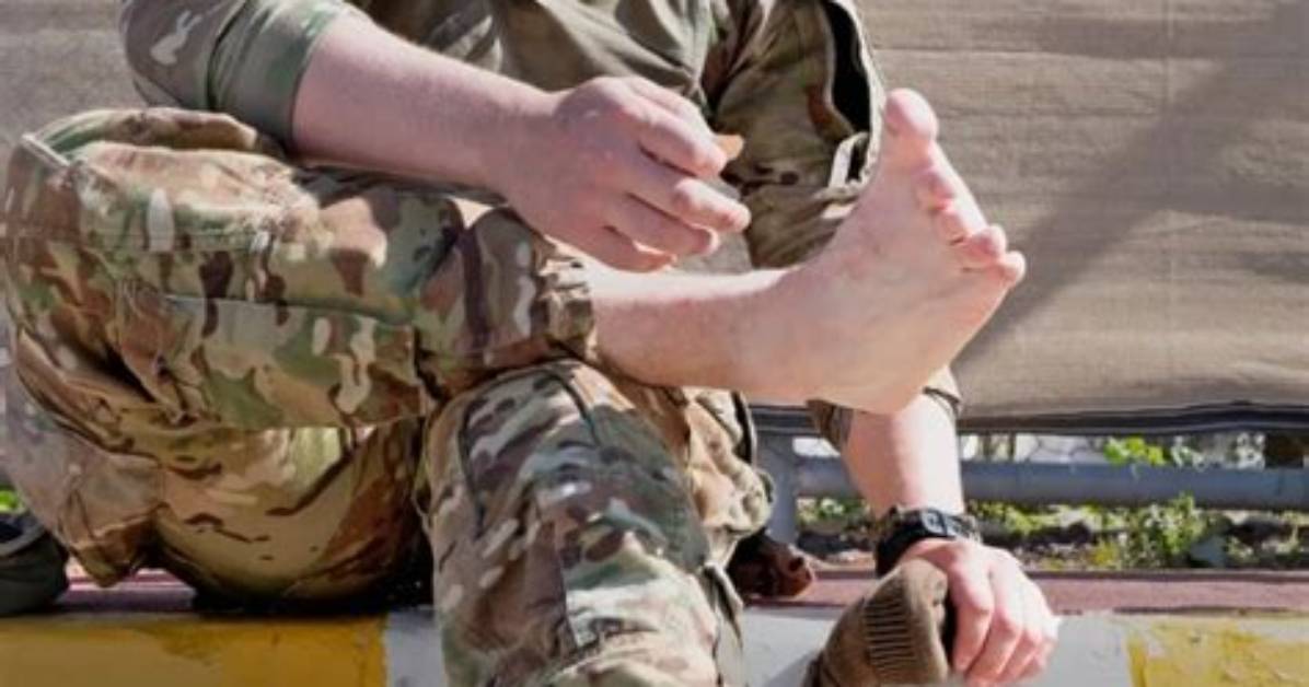 Can You Join Military with Missing Toe?