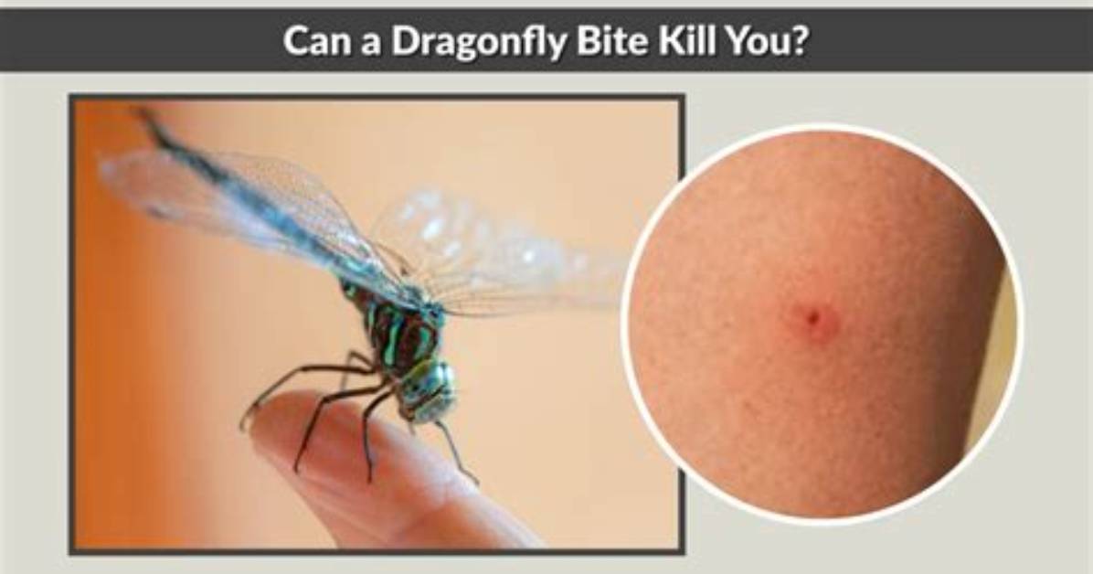 Can You Kill a Dragonfly