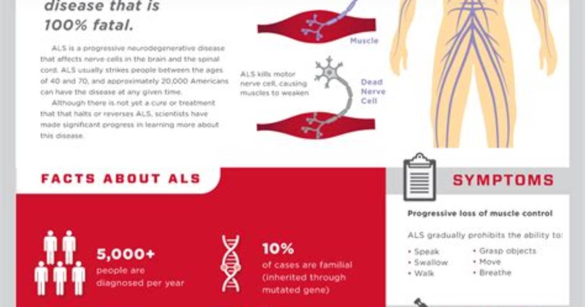 Can You Prevent Als