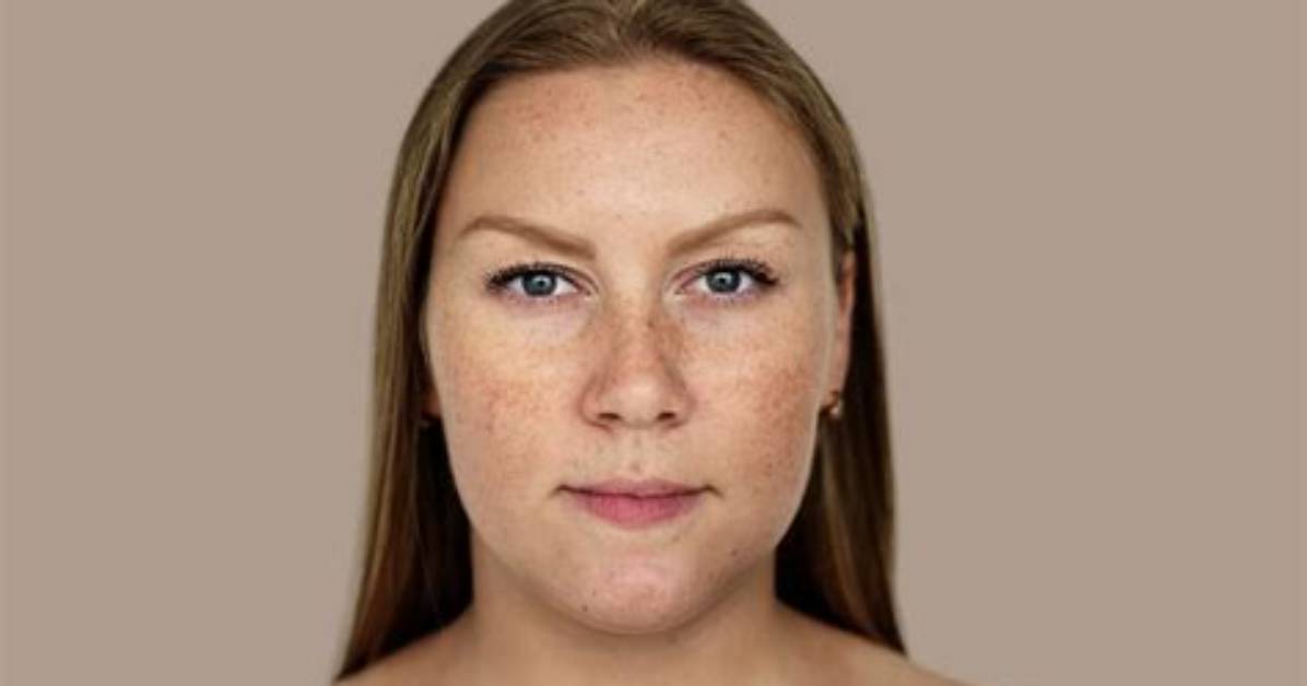 Can You Reverse Pigmentation?