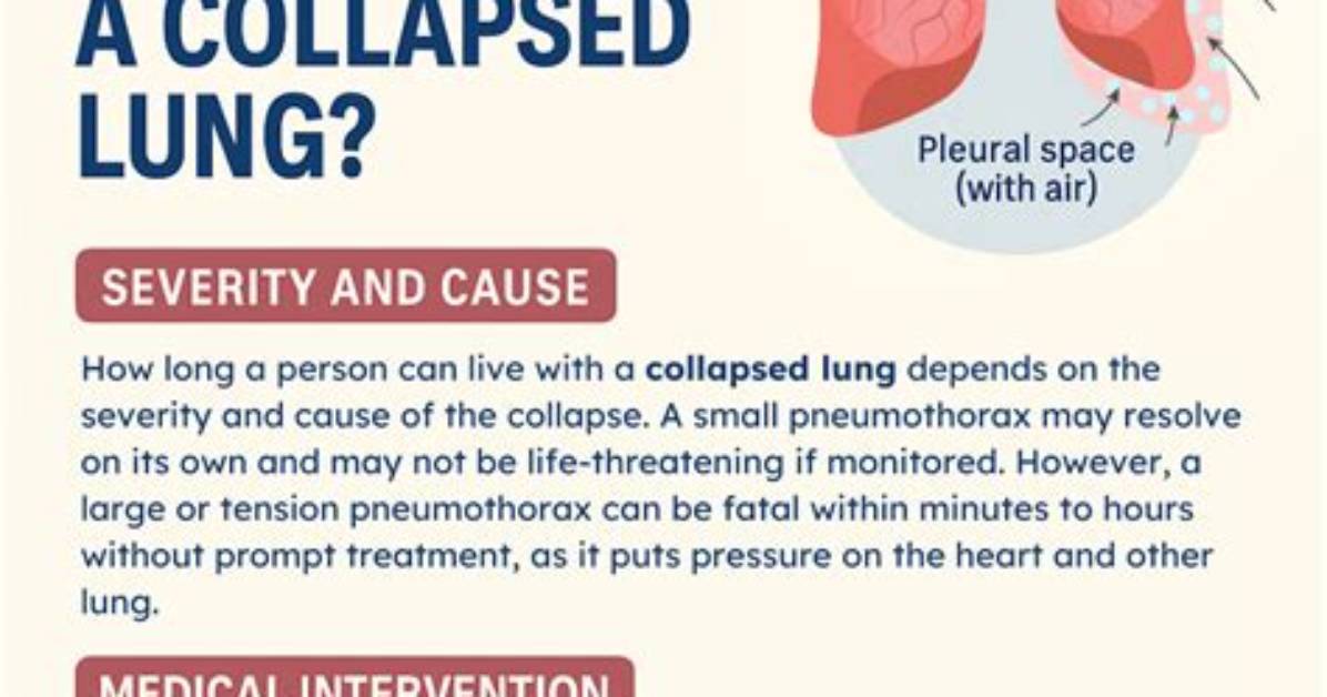 Can Your Lung Collapse?