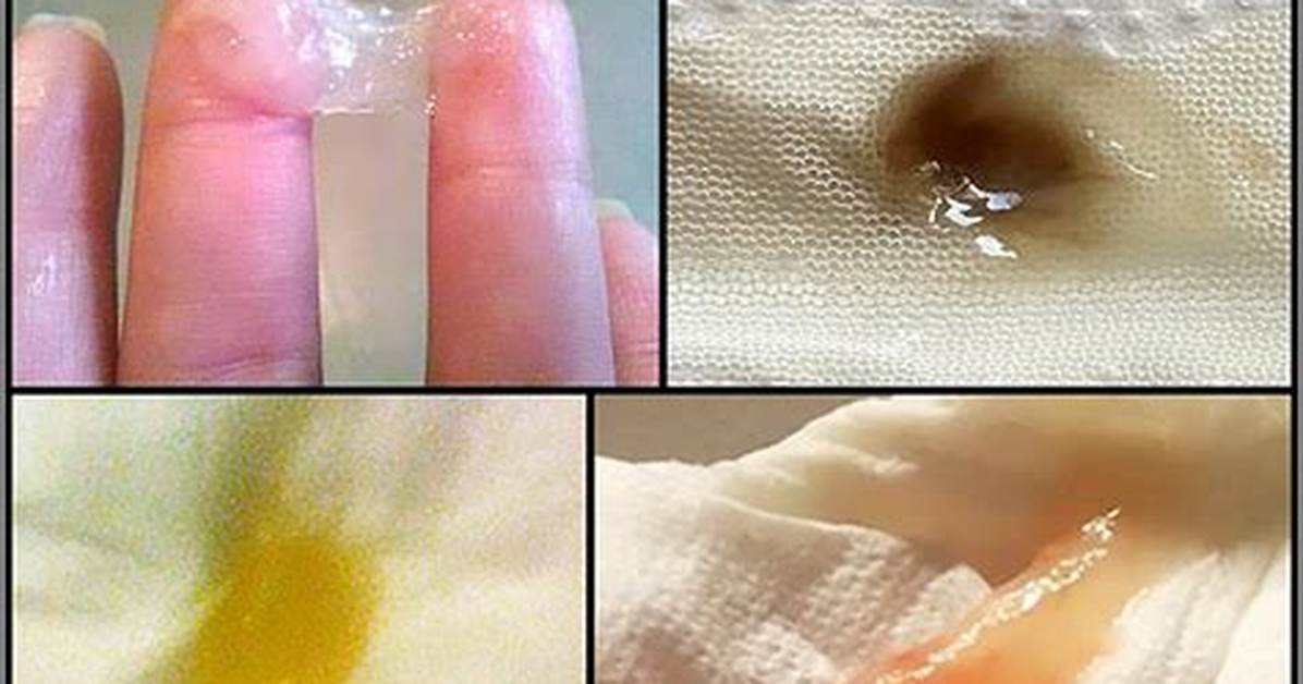 Can Your Mucus Plug Be Yellowish?