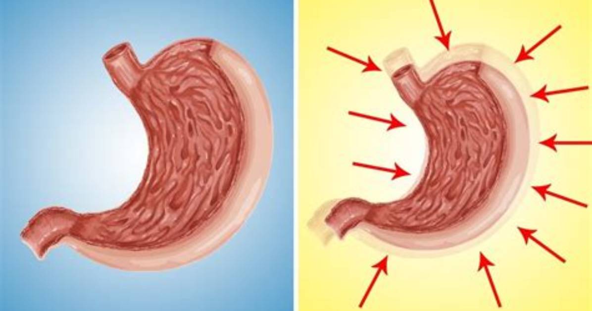 Can Your Stomach Size Shrink?