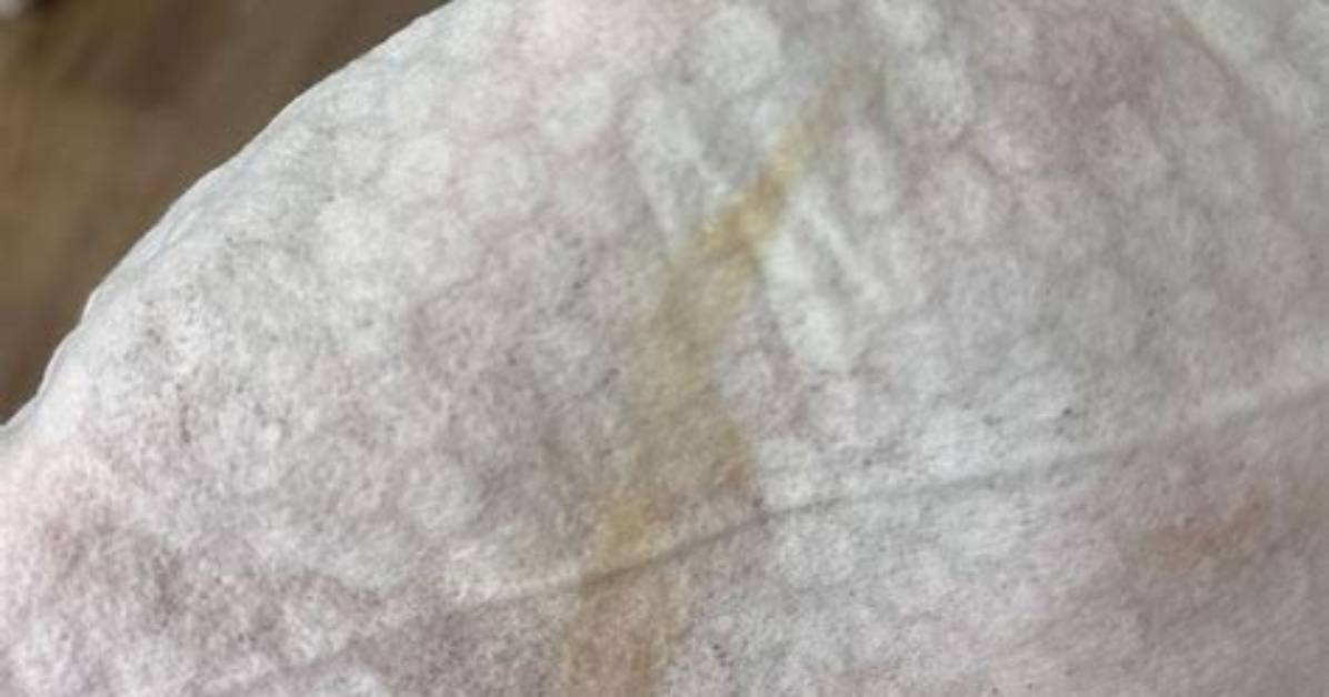 Could I Be Dilated at 34 Weeks?